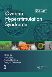 Ovarian Hyperstimulation Syndrome